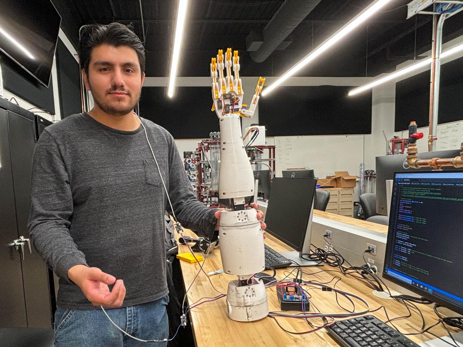 Prosthetic Arm